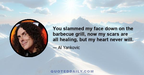 You slammed my face down on the barbecue grill, now my scars are all healing, but my heart never will.