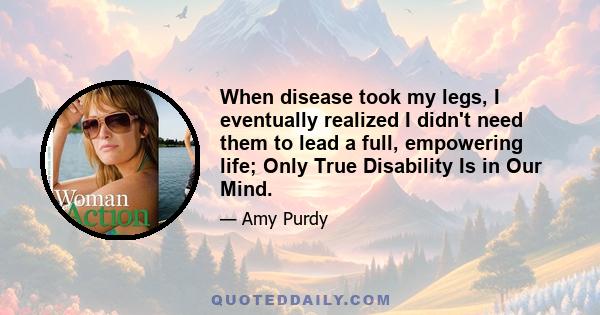 When disease took my legs, I eventually realized I didn't need them to lead a full, empowering life; Only True Disability Is in Our Mind.