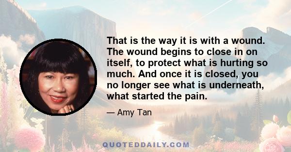 That is the way it is with a wound. The wound begins to close in on itself, to protect what is hurting so much. And once it is closed, you no longer see what is underneath, what started the pain.