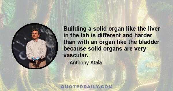 Building a solid organ like the liver in the lab is different and harder than with an organ like the bladder because solid organs are very vascular.