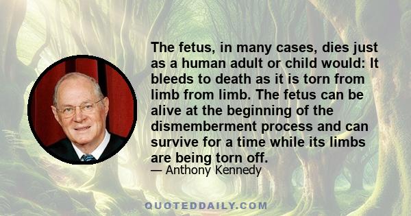 The fetus, in many cases, dies just as a human adult or child would: It bleeds to death as it is torn from limb from limb. The fetus can be alive at the beginning of the dismemberment process and can survive for a time