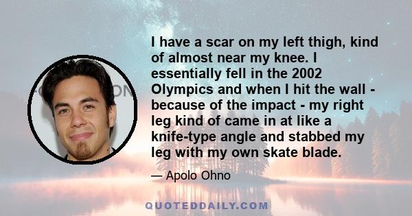 I have a scar on my left thigh, kind of almost near my knee. I essentially fell in the 2002 Olympics and when I hit the wall - because of the impact - my right leg kind of came in at like a knife-type angle and stabbed