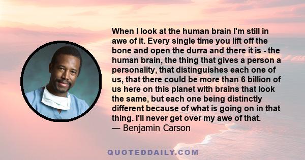 When I look at the human brain I'm still in awe of it. Every single time you lift off the bone and open the durra and there it is - the human brain, the thing that gives a person a personality, that distinguishes each