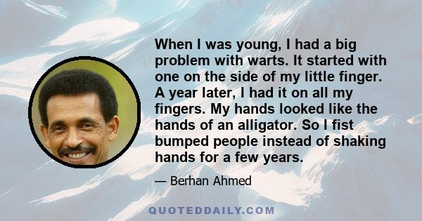 When I was young, I had a big problem with warts. It started with one on the side of my little finger. A year later, I had it on all my fingers. My hands looked like the hands of an alligator. So I fist bumped people