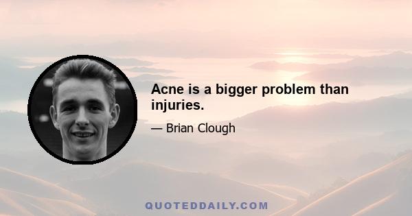 Acne is a bigger problem than injuries.