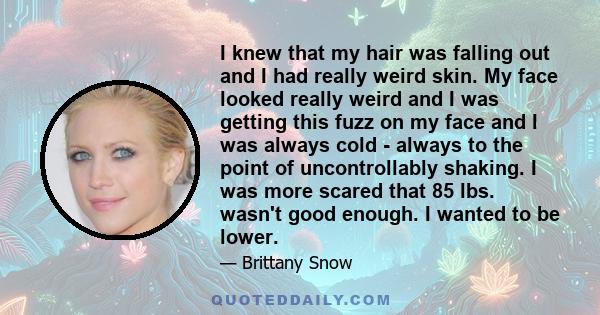 I knew that my hair was falling out and I had really weird skin. My face looked really weird and I was getting this fuzz on my face and I was always cold - always to the point of uncontrollably shaking. I was more