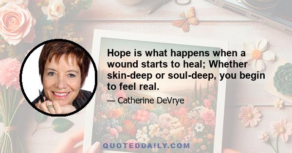 Hope is what happens when a wound starts to heal; Whether skin-deep or soul-deep, you begin to feel real.