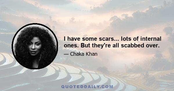 I have some scars... lots of internal ones. But they're all scabbed over.