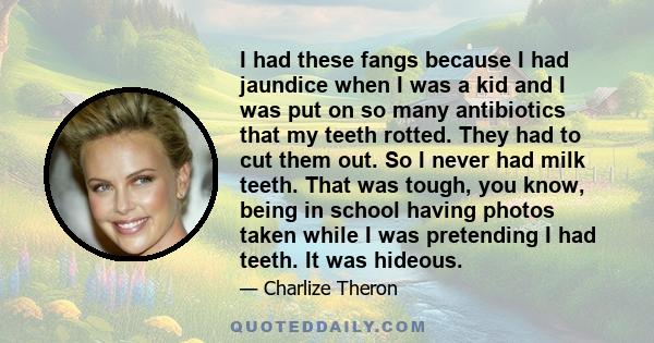 I had these fangs because I had jaundice when I was a kid and I was put on so many antibiotics that my teeth rotted. They had to cut them out. So I never had milk teeth. That was tough, you know, being in school having