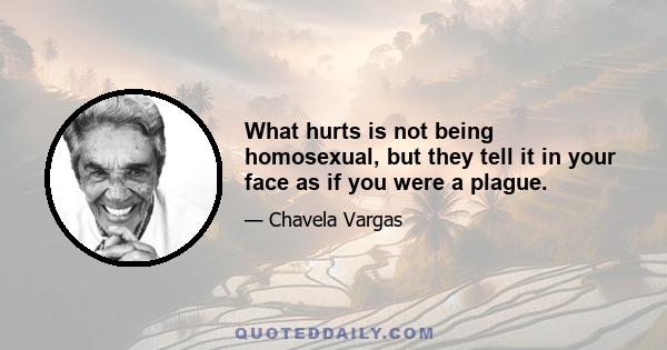 What hurts is not being homosexual, but they tell it in your face as if you were a plague.