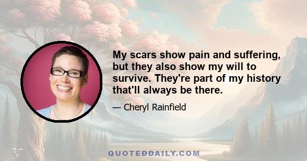 My scars show pain and suffering, but they also show my will to survive. They're part of my history that'll always be there.