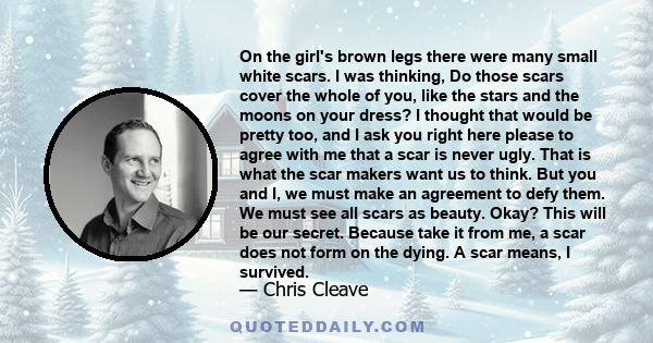 On the girl's brown legs there were many small white scars. I was thinking, Do those scars cover the whole of you, like the stars and the moons on your dress? I thought that would be pretty too, and I ask you right here 