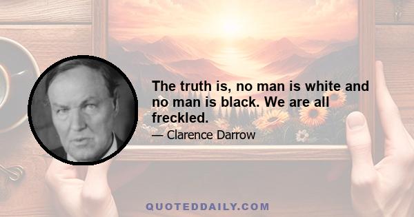 The truth is, no man is white and no man is black. We are all freckled.