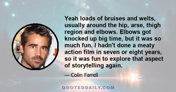 Yeah loads of bruises and welts, usually around the hip, arse, thigh region and elbows. Elbows got knocked up big time, but it was so much fun. I hadn't done a meaty action film in seven or eight years, so it was fun to 