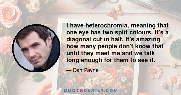 I have heterochromia, meaning that one eye has two split colours. It's a diagonal cut in half. It's amazing how many people don't know that until they meet me and we talk long enough for them to see it.