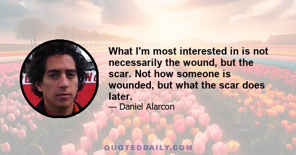 What I'm most interested in is not necessarily the wound, but the scar. Not how someone is wounded, but what the scar does later.