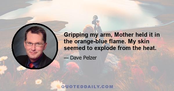 Gripping my arm, Mother held it in the orange-blue flame. My skin seemed to explode from the heat.