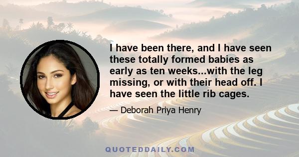 I have been there, and I have seen these totally formed babies as early as ten weeks...with the leg missing, or with their head off. I have seen the little rib cages.