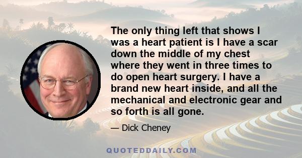 The only thing left that shows I was a heart patient is I have a scar down the middle of my chest where they went in three times to do open heart surgery. I have a brand new heart inside, and all the mechanical and