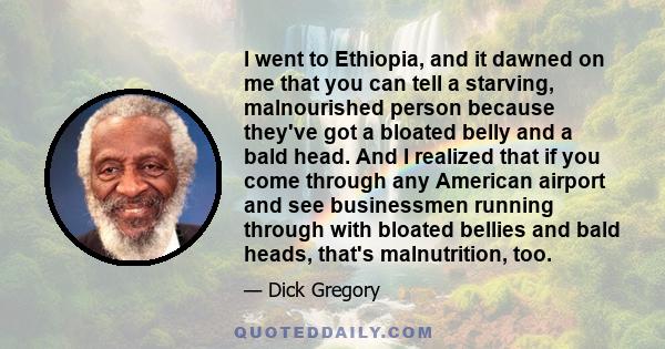 I went to Ethiopia, and it dawned on me that you can tell a starving, malnourished person because they've got a bloated belly and a bald head. And I realized that if you come through any American airport and see