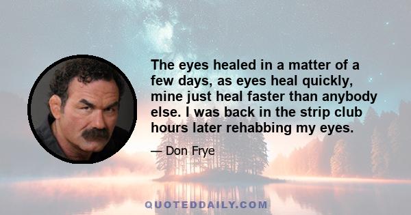 The eyes healed in a matter of a few days, as eyes heal quickly, mine just heal faster than anybody else. I was back in the strip club hours later rehabbing my eyes.