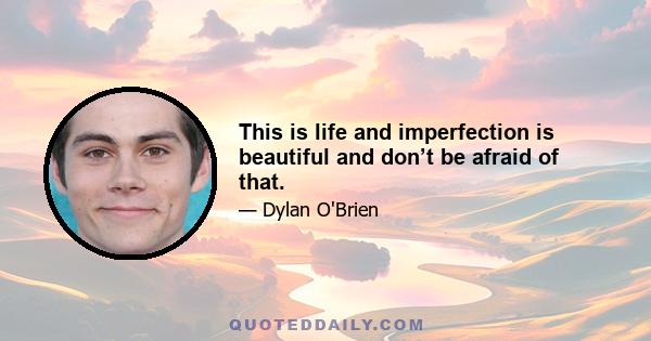 This is life and imperfection is beautiful and don’t be afraid of that.