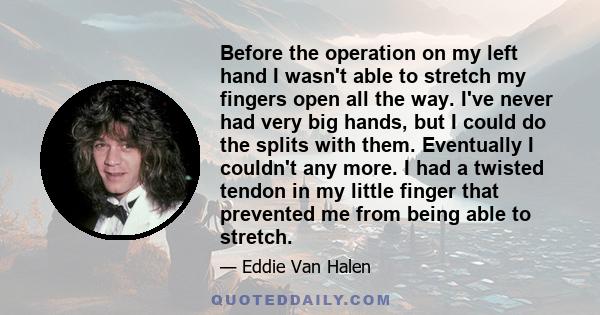 Before the operation on my left hand I wasn't able to stretch my fingers open all the way. I've never had very big hands, but I could do the splits with them. Eventually I couldn't any more. I had a twisted tendon in my 