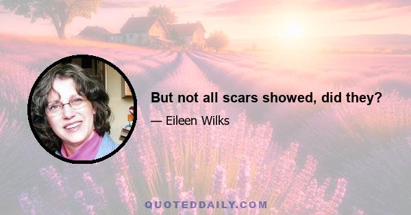 But not all scars showed, did they?