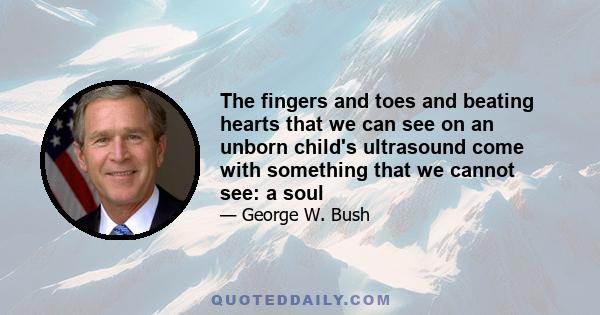 The fingers and toes and beating hearts that we can see on an unborn child's ultrasound come with something that we cannot see: a soul