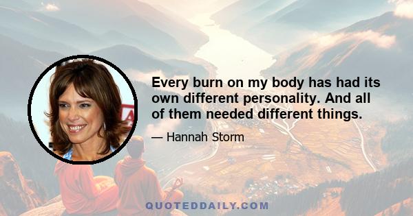 Every burn on my body has had its own different personality. And all of them needed different things.