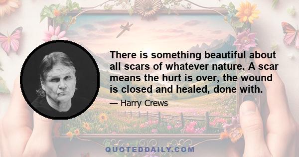 There is something beautiful about all scars of whatever nature. A scar means the hurt is over, the wound is closed and healed, done with.