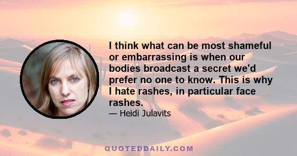 I think what can be most shameful or embarrassing is when our bodies broadcast a secret we'd prefer no one to know. This is why I hate rashes, in particular face rashes.