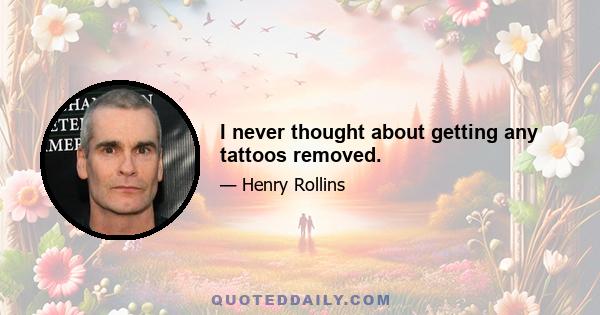 I never thought about getting any tattoos removed.