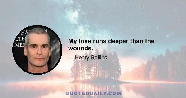 My love runs deeper than the wounds.