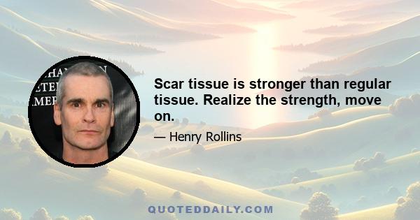 Scar tissue is stronger than regular tissue. Realize the strength, move on.