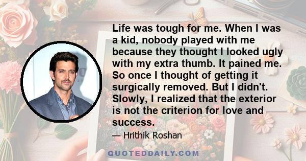 Life was tough for me. When I was a kid, nobody played with me because they thought I looked ugly with my extra thumb. It pained me. So once I thought of getting it surgically removed. But I didn't. Slowly, I realized