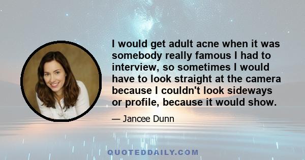 I would get adult acne when it was somebody really famous I had to interview, so sometimes I would have to look straight at the camera because I couldn't look sideways or profile, because it would show.