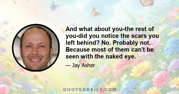 And what about you-the rest of you-did you notice the scars you left behind? No. Probably not. Because most of them can't be seen with the naked eye.