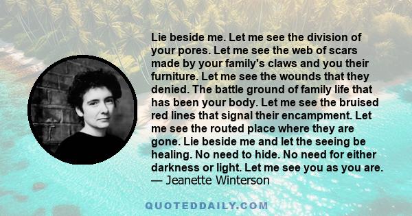 Lie beside me. Let me see the division of your pores. Let me see the web of scars made by your family's claws and you their furniture. Let me see the wounds that they denied. The battle ground of family life that has