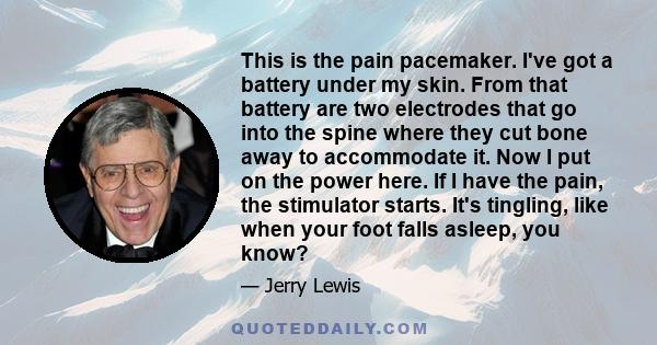 This is the pain pacemaker. I've got a battery under my skin. From that battery are two electrodes that go into the spine where they cut bone away to accommodate it. Now I put on the power here. If I have the pain, the