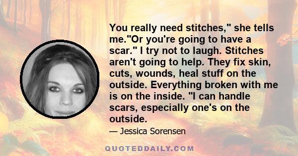 You really need stitches, she tells me.Or you're going to have a scar. I try not to laugh. Stitches aren't going to help. They fix skin, cuts, wounds, heal stuff on the outside. Everything broken with me is on the