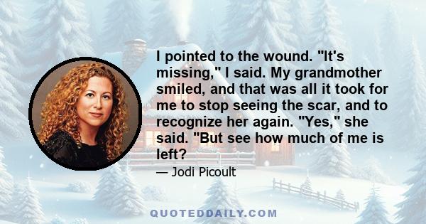 I pointed to the wound. It's missing, I said. My grandmother smiled, and that was all it took for me to stop seeing the scar, and to recognize her again. Yes, she said. But see how much of me is left?