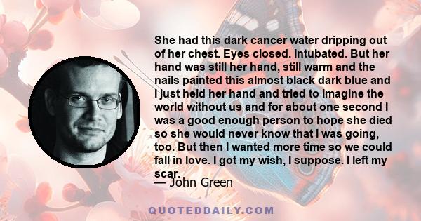 She had this dark cancer water dripping out of her chest. Eyes closed. Intubated. But her hand was still her hand, still warm and the nails painted this almost black dark blue and I just held her hand and tried to