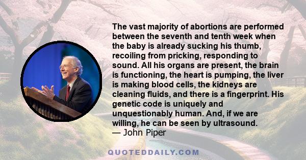 The vast majority of abortions are performed between the seventh and tenth week when the baby is already sucking his thumb, recoiling from pricking, responding to sound. All his organs are present, the brain is