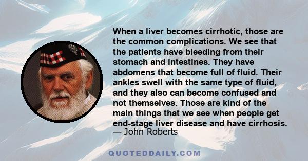 When a liver becomes cirrhotic, those are the common complications. We see that the patients have bleeding from their stomach and intestines. They have abdomens that become full of fluid. Their ankles swell with the