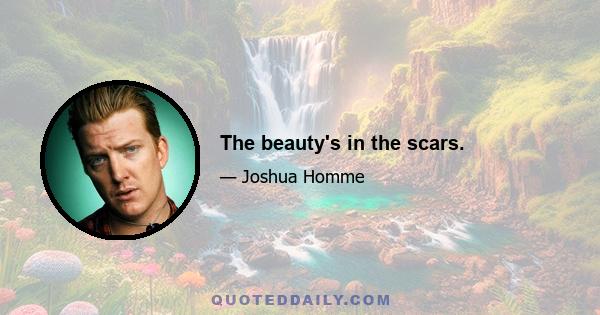 The beauty's in the scars.