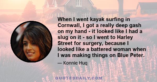 When I went kayak surfing in Cornwall, I got a really deep gash on my hand - it looked like I had a slug on it - so I went to Harley Street for surgery, because I looked like a battered woman when I was making things on 