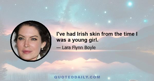 I've had Irish skin from the time I was a young girl.