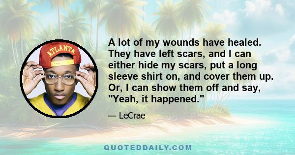 A lot of my wounds have healed. They have left scars, and I can either hide my scars, put a long sleeve shirt on, and cover them up. Or, I can show them off and say, Yeah, it happened.