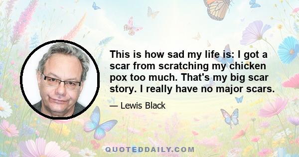 This is how sad my life is: I got a scar from scratching my chicken pox too much. That's my big scar story. I really have no major scars.